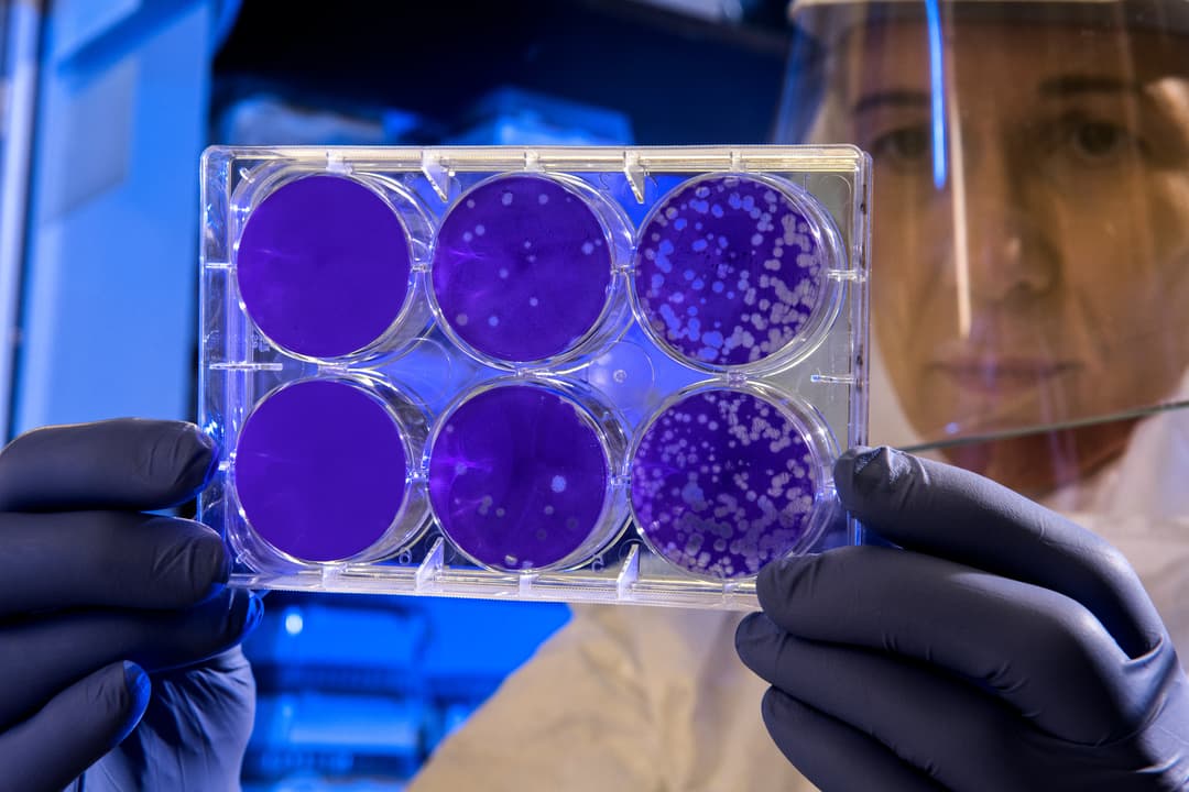 Doctor holding bacteria tray